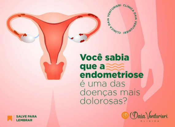 Banner do post Você sabia que a endometriose é uma das doenças mais dolorosas?