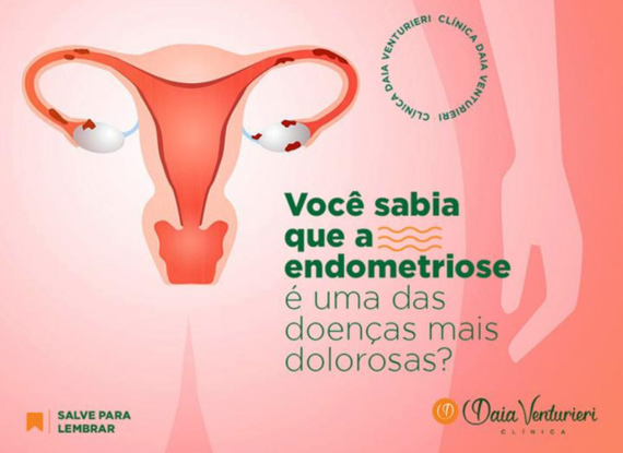 Imagem do post Você sabia que a endometriose é uma das doenças mais dolorosas?