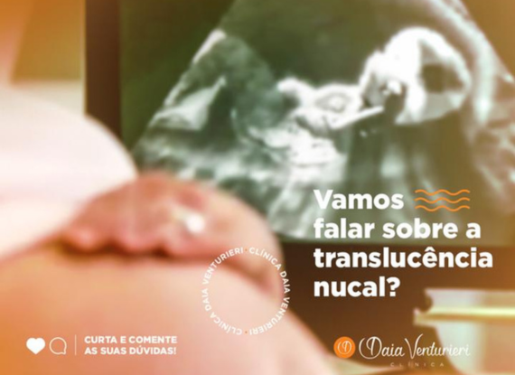 Imagem do post Vamos falar sobre a translucência nucal?